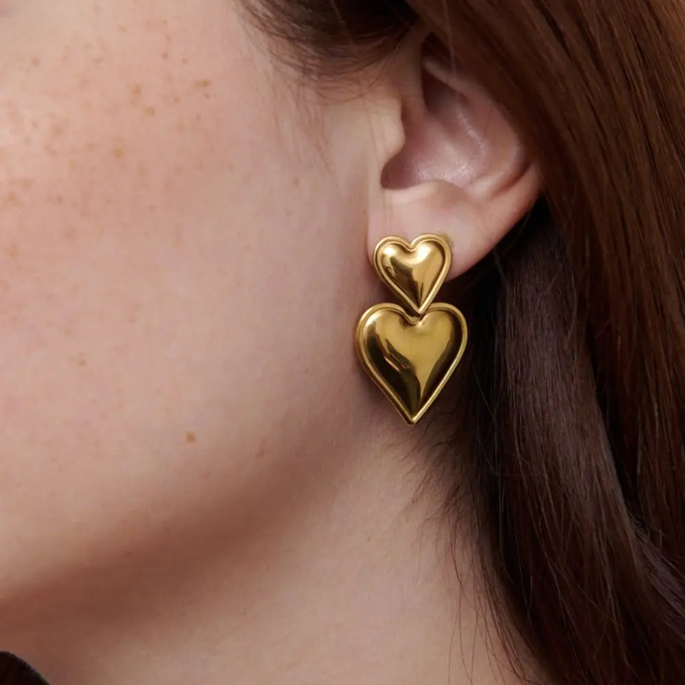 Aretes